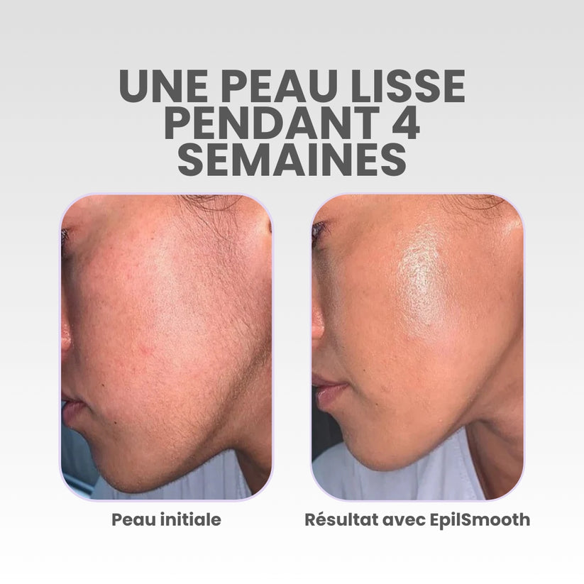 EpilSmooth Pro - Épilateur visage