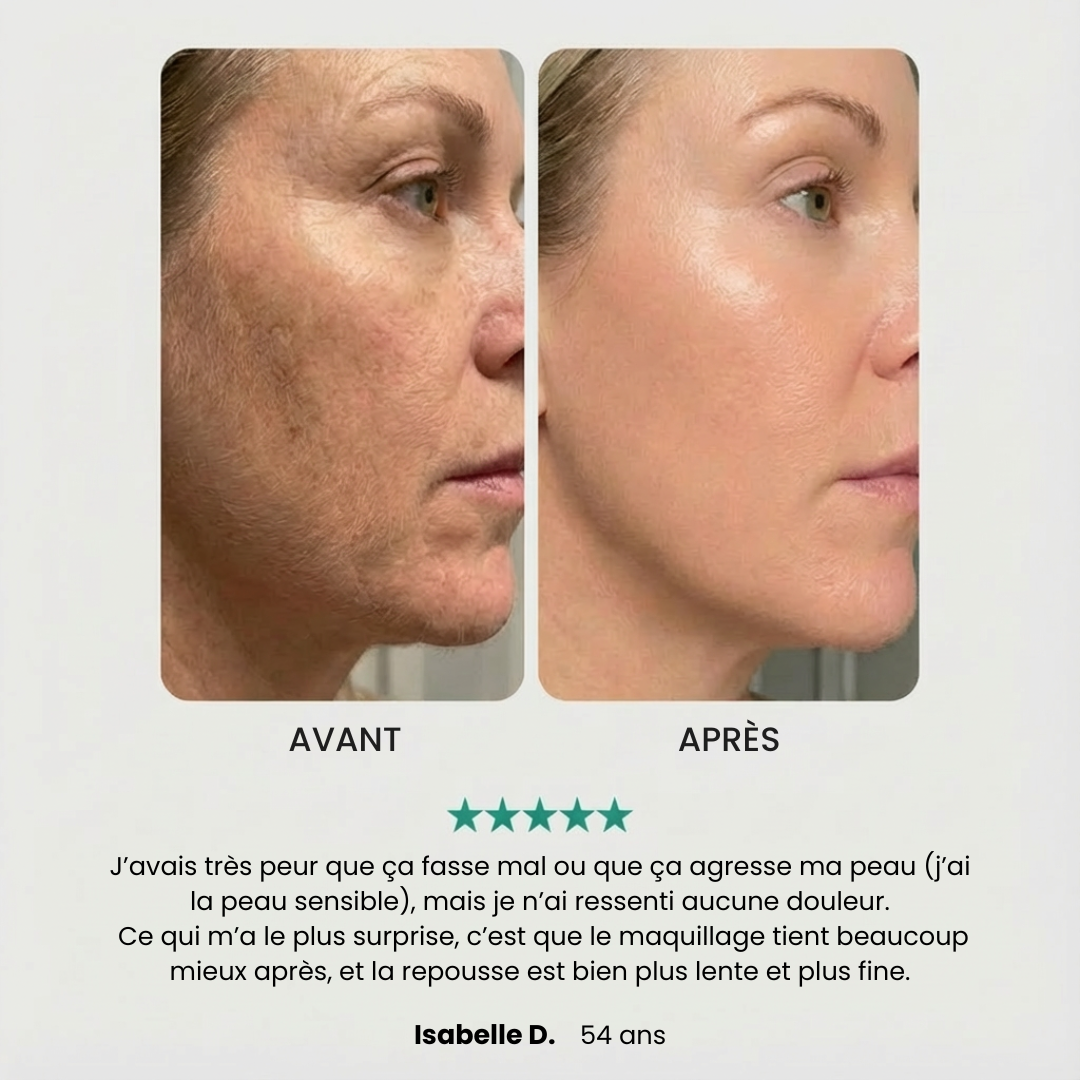 EpilSmooth Pro - Épilateur visage